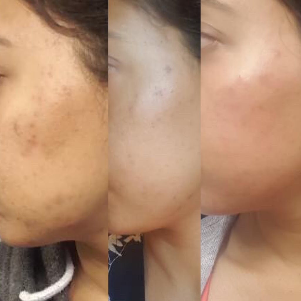 Reesha- Customized Facials & Skincare | 2766 Langlois Ct, Windsor, ON N8X 4T8, Canada | Phone: (519) 984-4786
