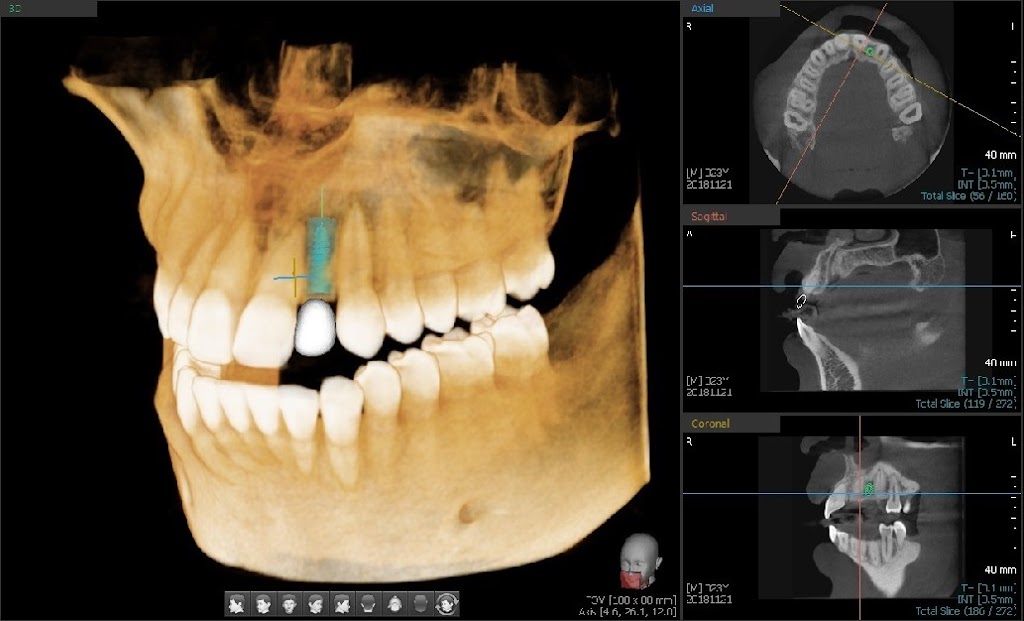 Clemmons Comprehensive Dental Care | 6824 River Center Dr, Clemmons, NC 27012 | Phone: (336) 293-6623