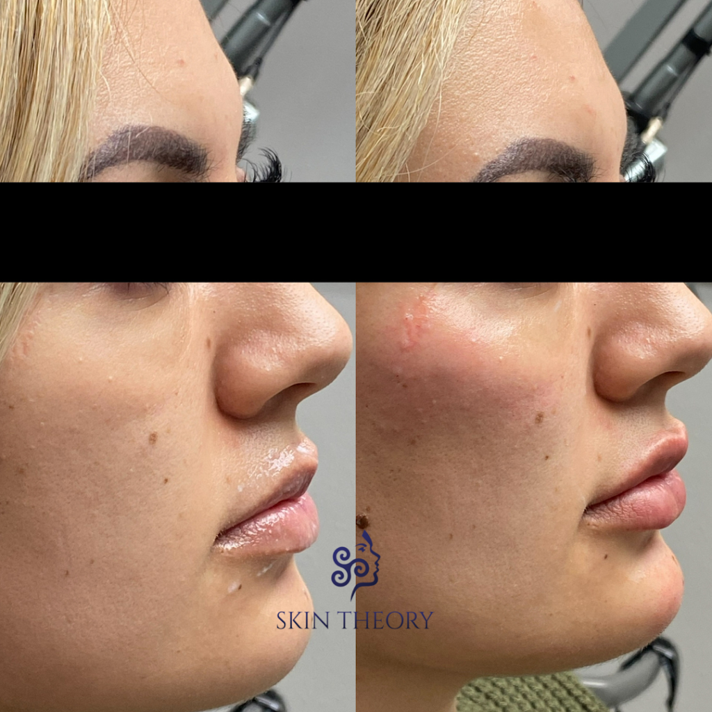 Skin Theory Aesthetics | 2791 Green River Rd STE 103, Corona, CA 92882, USA | Phone: (951) 735-5570