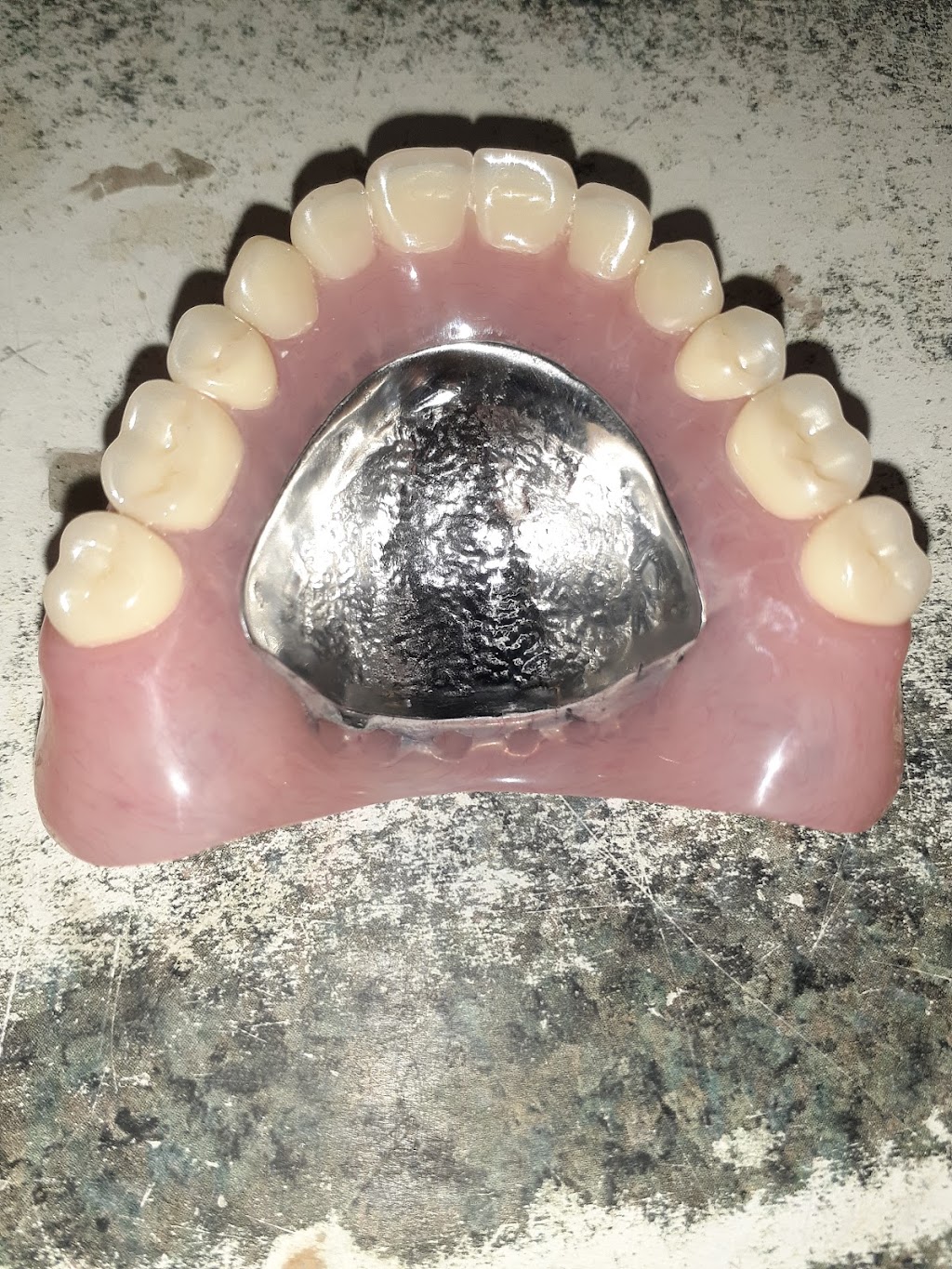 R&B Dental Lab | 21374 Ramona Ave, Apple Valley, CA 92307, USA | Phone: (760) 261-2425