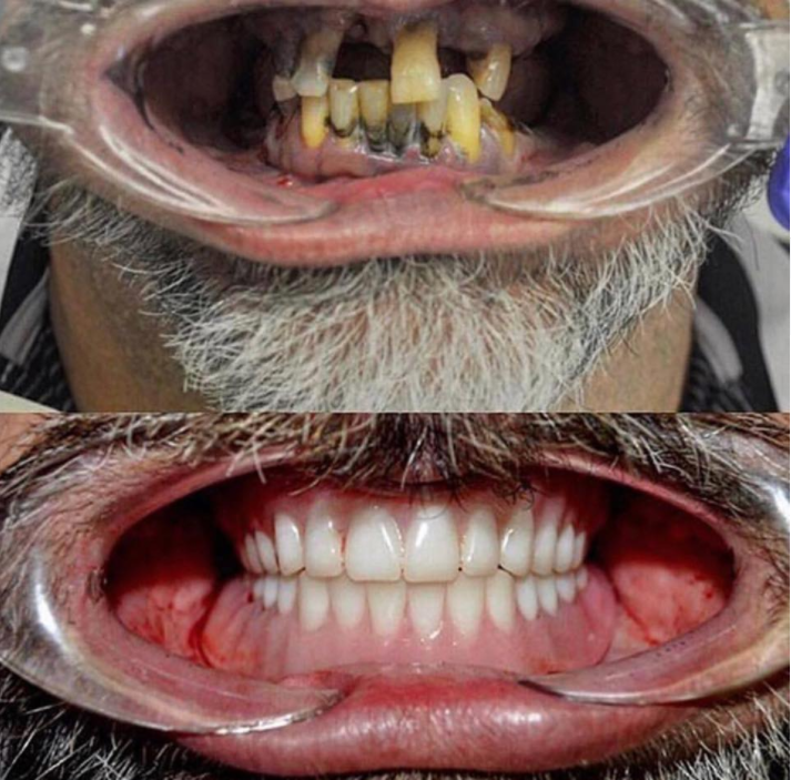 Shuayb Dental Institute - Brooksville | 12900 Cortez Blvd #201, Brooksville, FL 34613, USA | Phone: (352) 596-3456