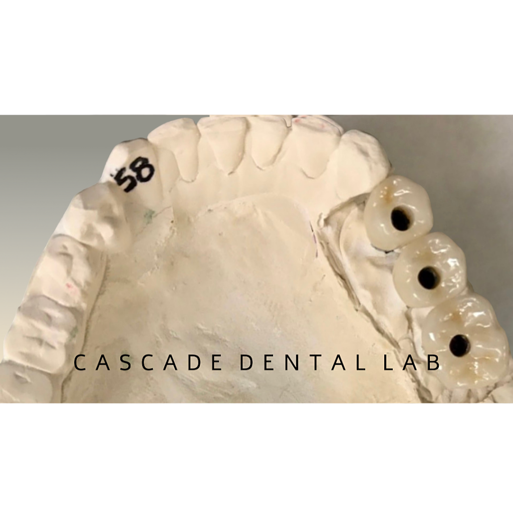 Cascade Dental Laboratory Inc | 1346 8th St NE, Auburn, WA 98002, USA | Phone: (253) 939-3540
