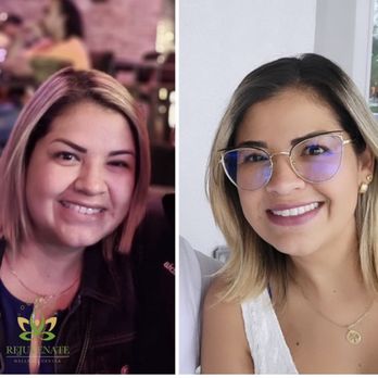 Rejuvenate & Wellness Center Lakeland | 4019 US Hwy 98 N Suite 124, Lakeland, FL 33809, USA | Phone: (321) 294-3586