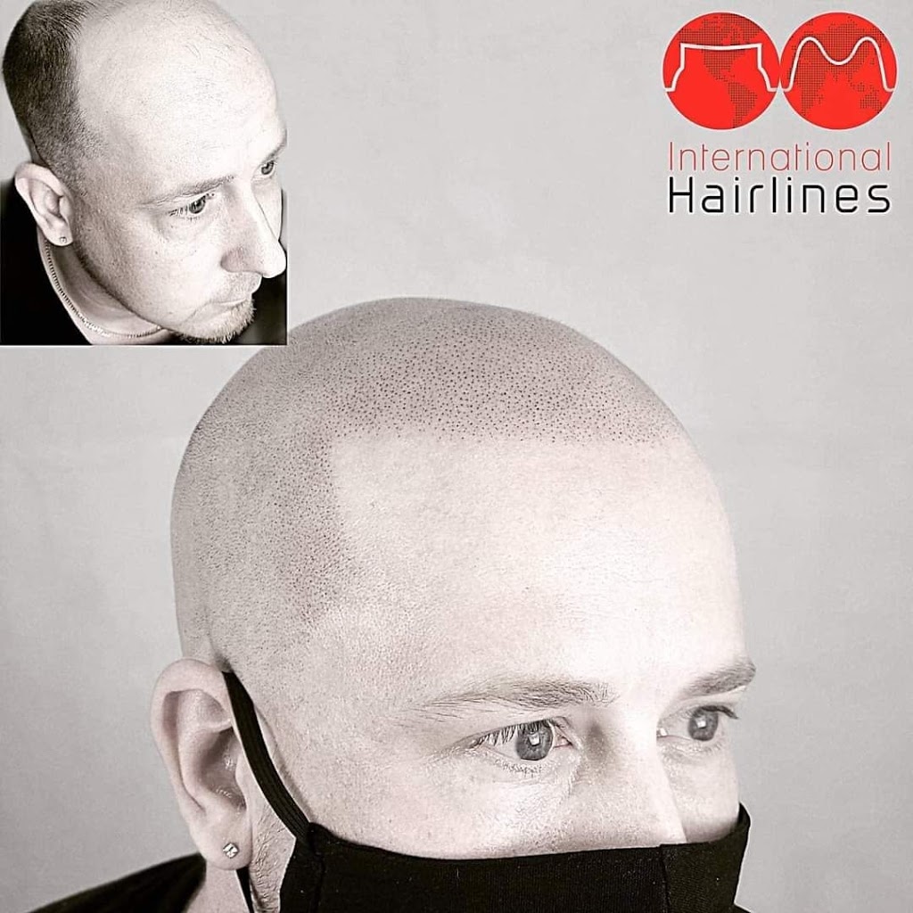 Pittsburgh International Hairlines | 2001 Montour Church Rd Second Floor, Oakdale, PA 15071 | Phone: (877) 567-3709