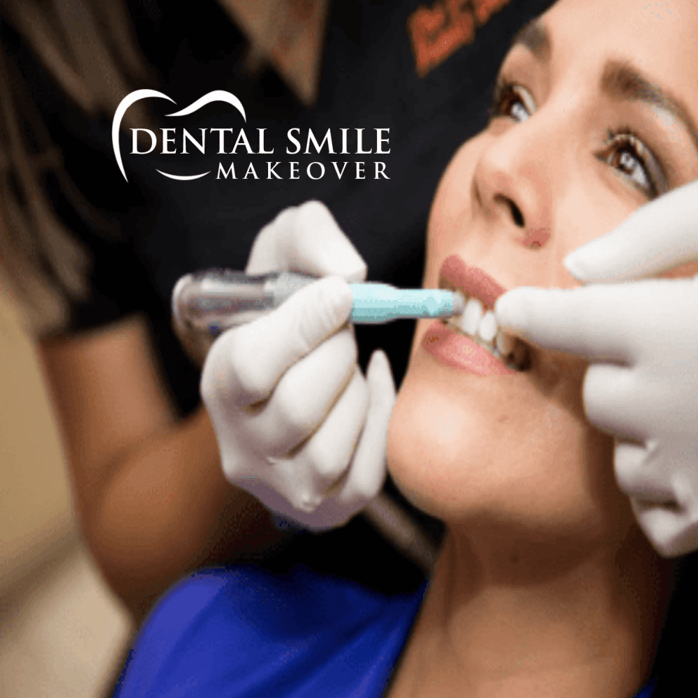 Dental Smile Makeover | 2090 Godby Rd, College Park, GA 30349, USA | Phone: (770) 991-0212