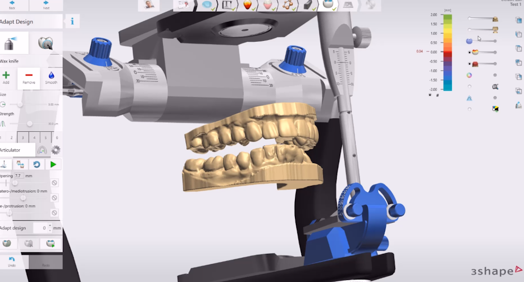 Chameleon Digital Dental Lab | 3731 NW Cary Pkwy #300, Cary, NC 27513, USA | Phone: (919) 696-5864