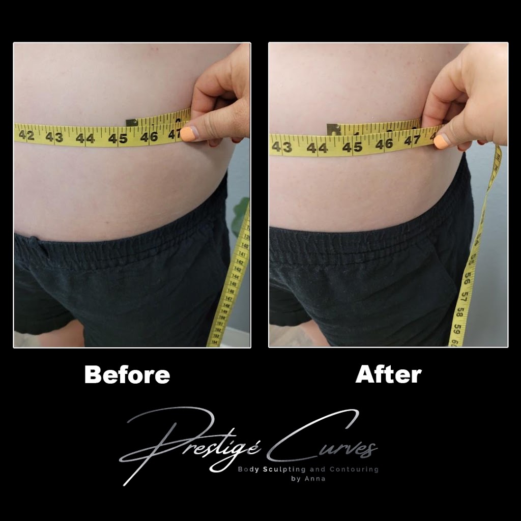 Prestigé Curves Body Sculpting | 520 W Lacey Blvd #3, Hanford, CA 93230, USA | Phone: (559) 904-9943