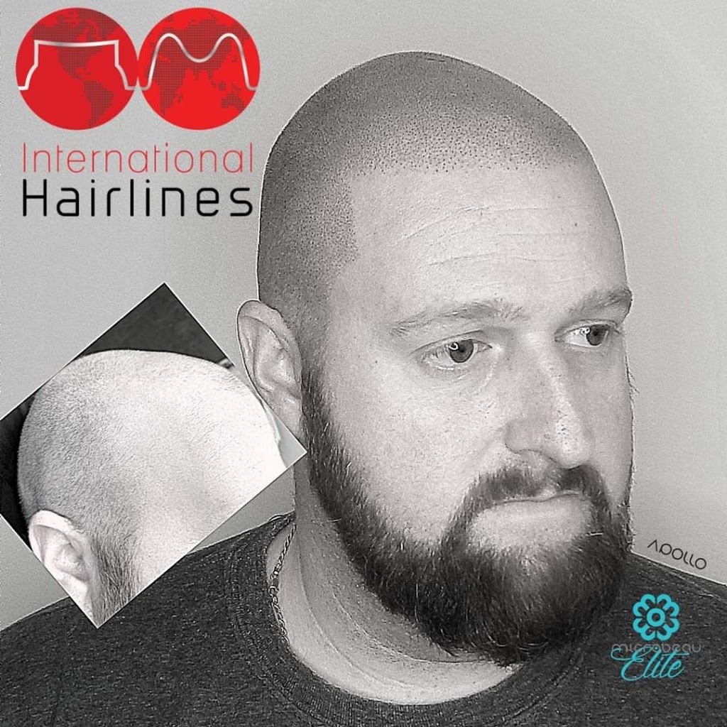 Pittsburgh International Hairlines | 2001 Montour Church Rd Second Floor, Oakdale, PA 15071 | Phone: (877) 567-3709