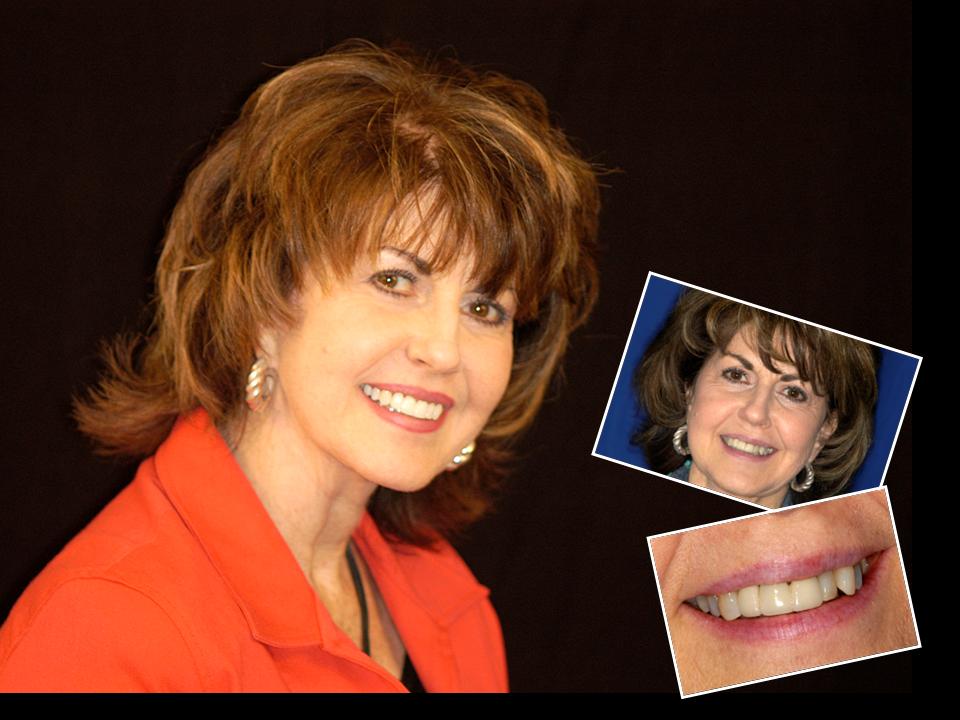 Anita Myers DDS | 134 Menger Springs #1310, Boerne, TX 78006, USA | Phone: (830) 816-5160