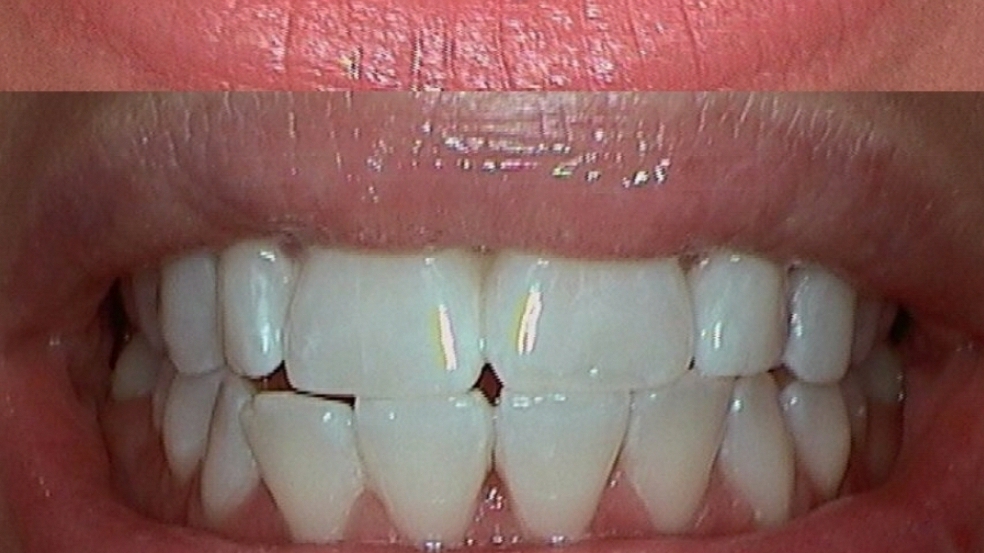 New Smiles Teeth Whitening | 222 Grifford Dr, Kissimmee, FL 34758, USA | Phone: (407) 279-0490