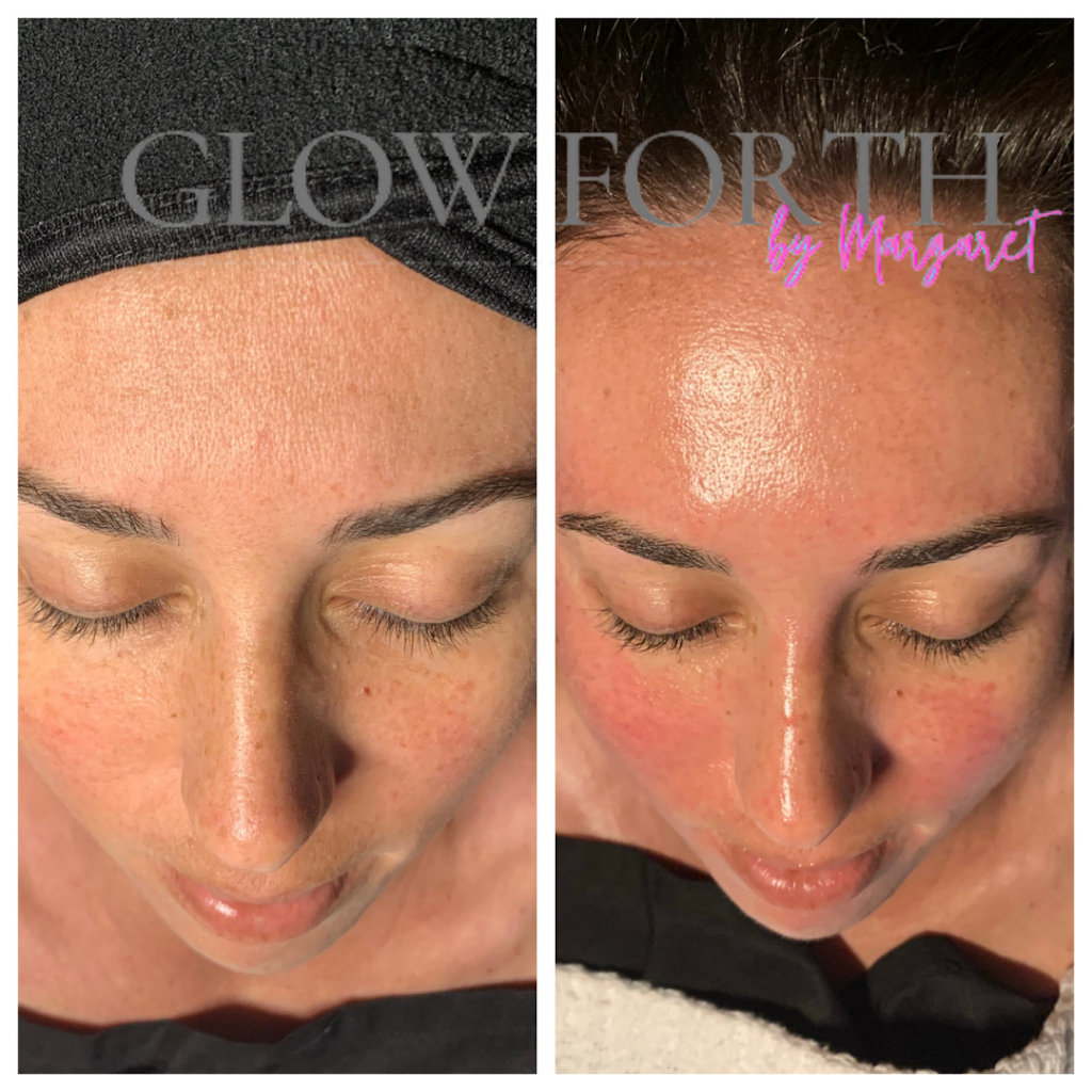 Glow Forth Spa & Artistry | 1415 Corporate Square Dr Unit B, Slidell, LA 70458, USA | Phone: (985) 503-9056