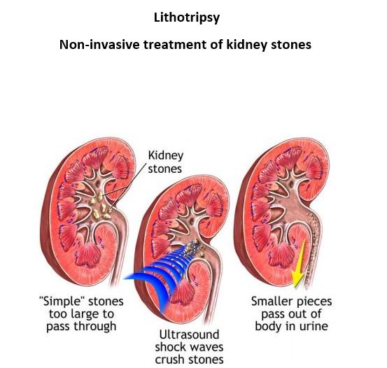 Alamance Urological PC: Wolff Michael R MD | 841 Heather Rd #6288, Burlington, NC 27215 | Phone: (336) 229-7776