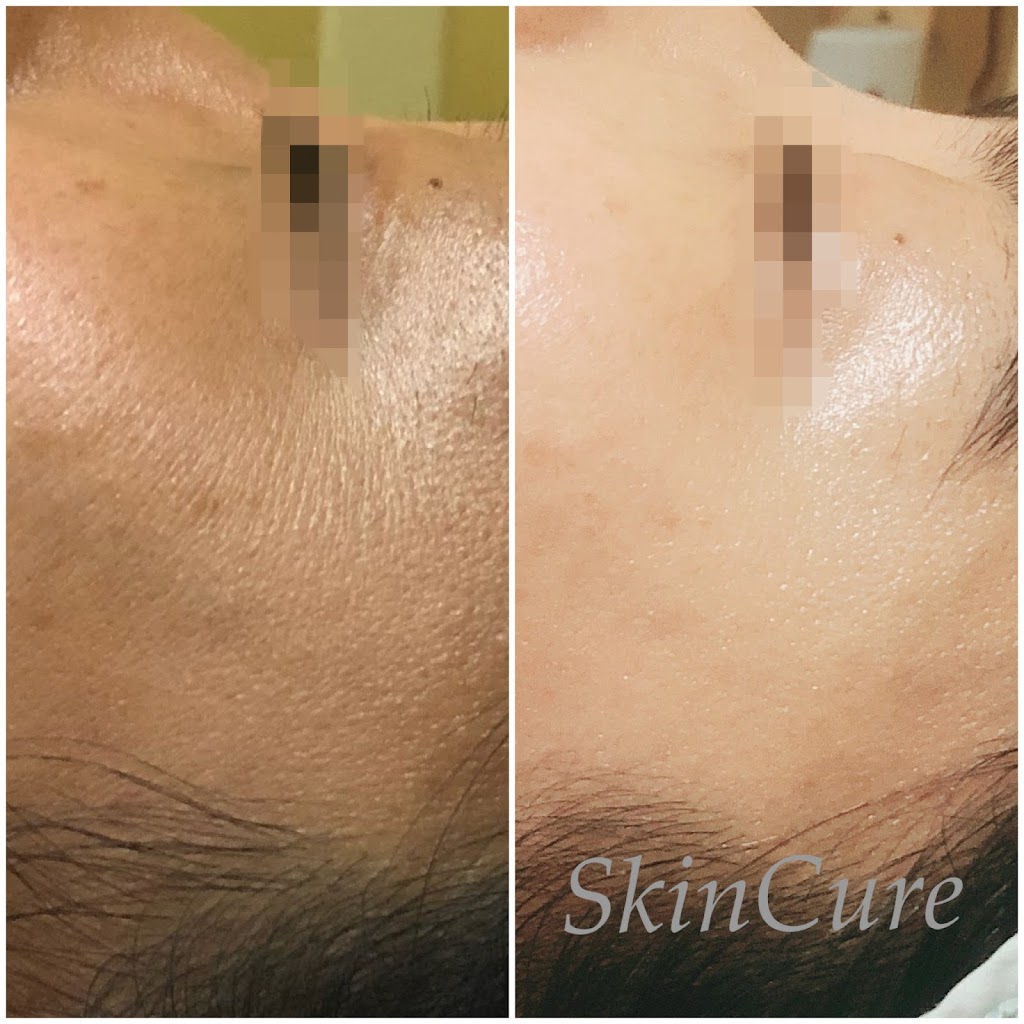 SkinCure K-beauty Spa | 5257 Stevens Creek Blvd, Santa Clara, CA 95051, USA | Phone: (408) 230-9608