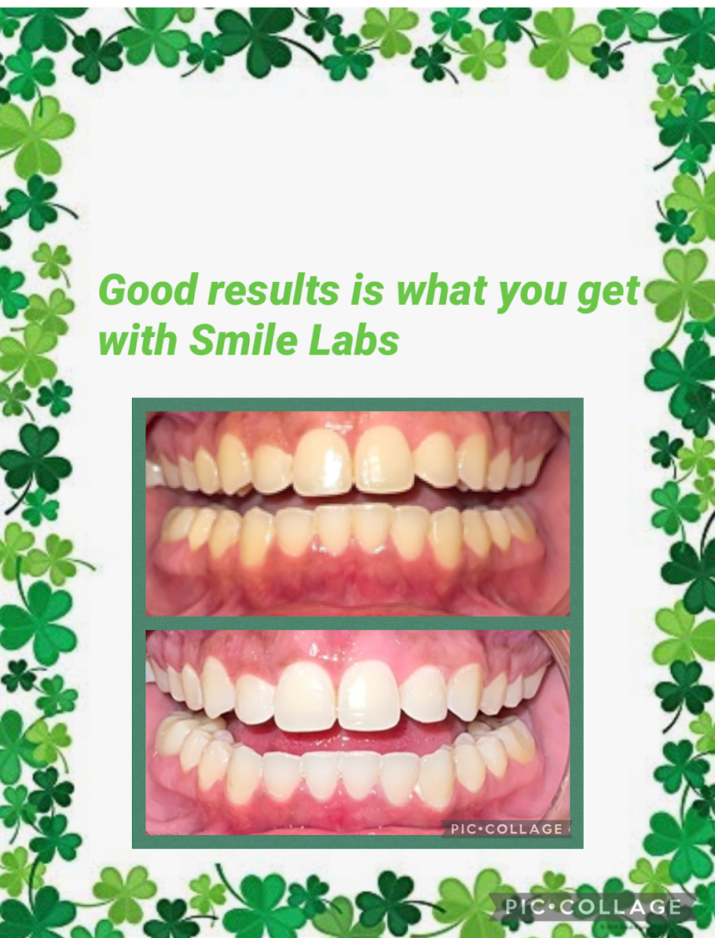 Smile Labs of Houma LLC | 112 Equity Blvd #102, Houma, LA 70360, USA | Phone: (985) 232-7793
