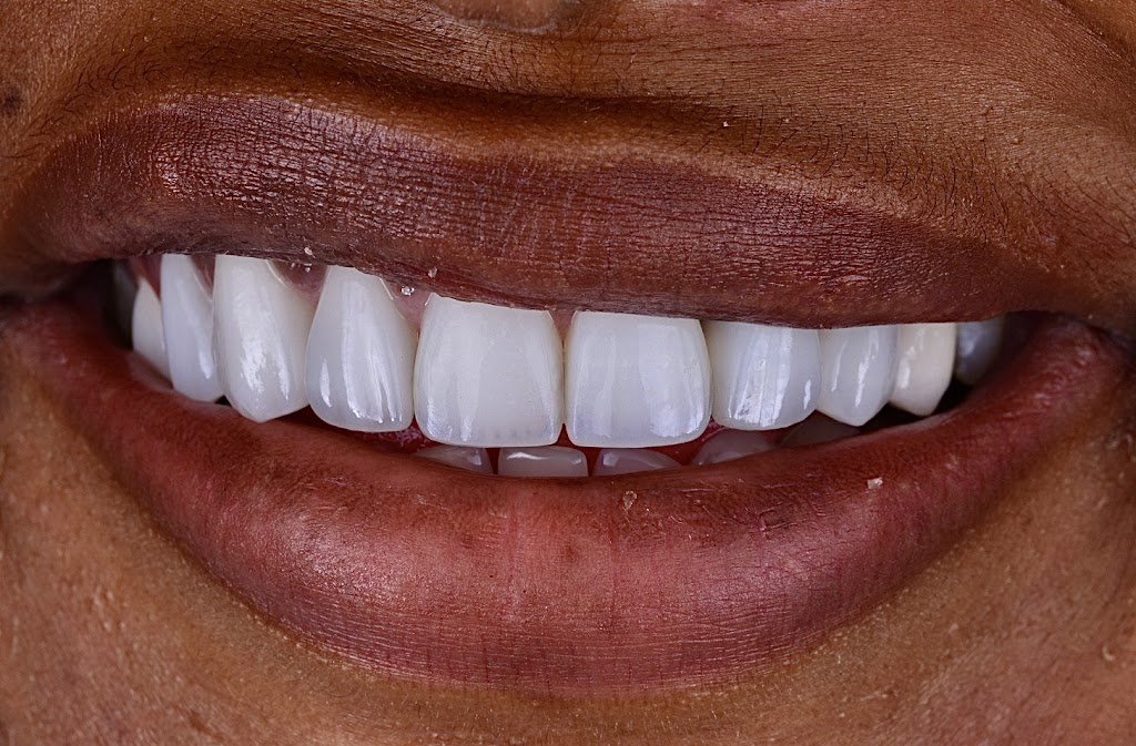 Modern Smiles | 10545 Victory Blvd, North Hollywood, CA 91606, USA | Phone: (818) 763-9353