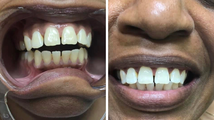 Snow White Teeth Services LLC | 11720 Beltsville Dr Suite 500, Beltsville, MD 20705, USA | Phone: (202) 213-6062