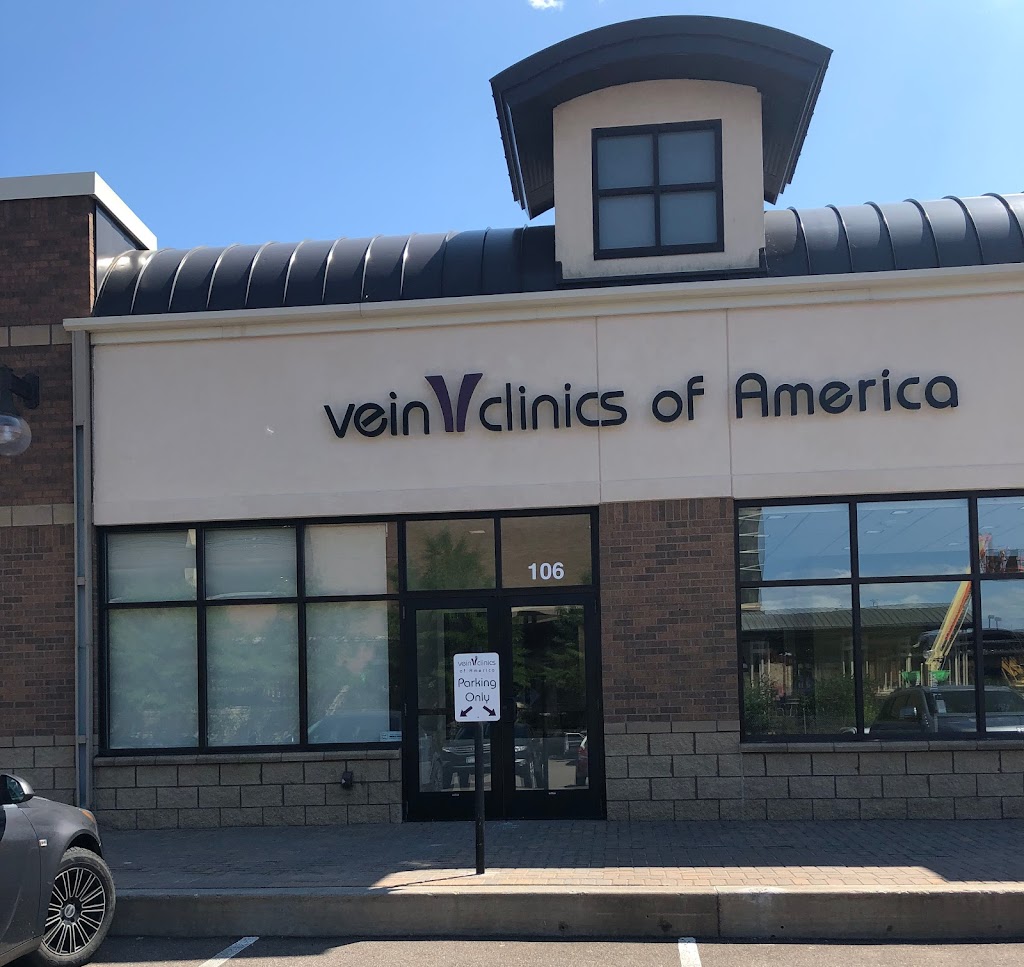 Vein Clinics of America: Dr. Mark Ciagne, MD | 13300 Technology Dr. STE 106, Eden Prairie, MN 55344, USA | Phone: (952) 934-4216