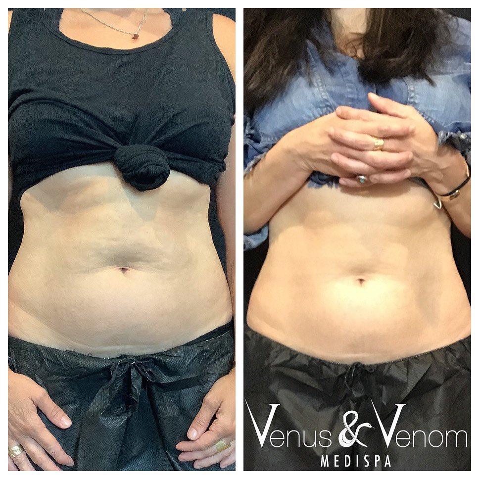 Venus & Venom | 78 S Middletown Rd, Nanuet, NY 10954, USA | Phone: (845) 623-8700