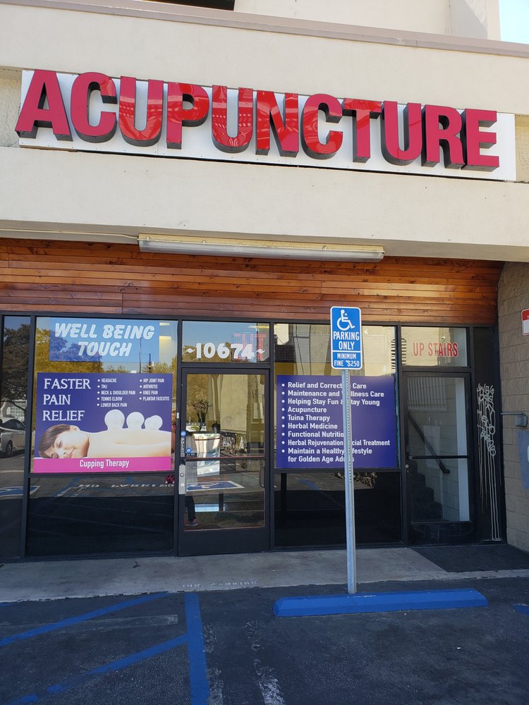 WellBeing Touch Acupuncture | 10674 Riverside Dr, North Hollywood, CA 91602, USA | Phone: (213) 800-3772