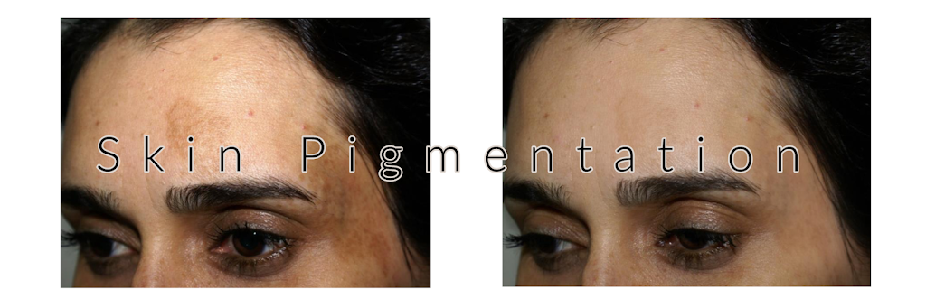 Veda Skin and Laser | 18580 Fort St, Riverview, MI 48193, USA | Phone: (734) 530-1561