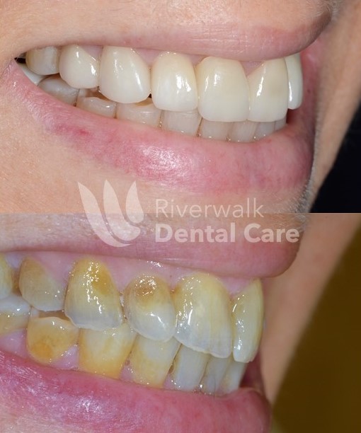 Riverwalk Dental Care | 351 Main Ave, Norwalk, CT 06851, USA | Phone: (203) 286-8668