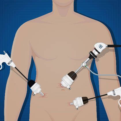 Urologist Tijuana | New City Medical Plaza, P.º del Centenario 9580 C 604, Zona Urbana Rio Tijuana, 22010 Tijuana, B.C., Mexico | Phone: (619) 392-8516