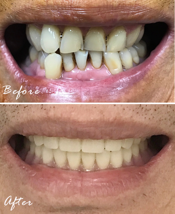 Vibrant Smiles Dentistry | 3992 Denton Hwy, North Richland Hills, TX 76117, USA | Phone: (817) 838-2344