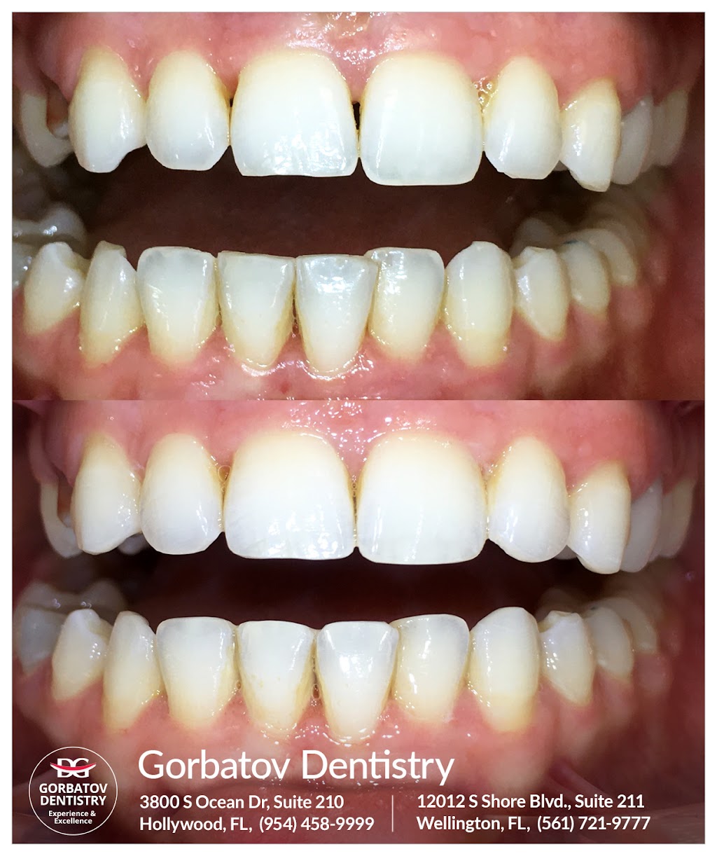 Dr. Gorbatov Dentistry | 3800 S Ocean Dr #210, Hollywood, FL 33019, USA | Phone: (954) 458-9999