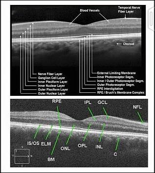 Master Eye Associates | 8880 TX-121 STE 141, McKinney, TX 75070, USA | Phone: (469) 854-6787