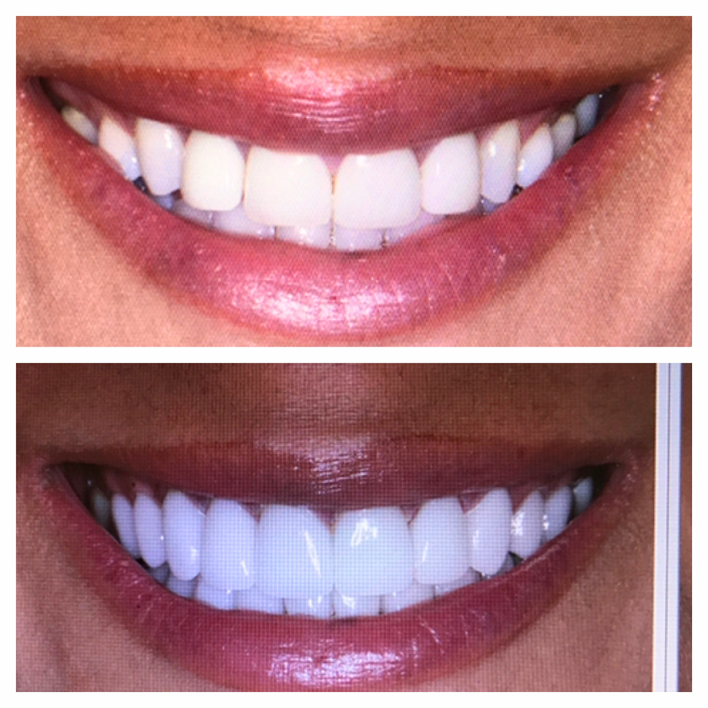 Smiles by Garcia | 2530 Walsh Tarlton Ln Suite 210, Austin, TX 78746, USA | Phone: (512) 402-5872