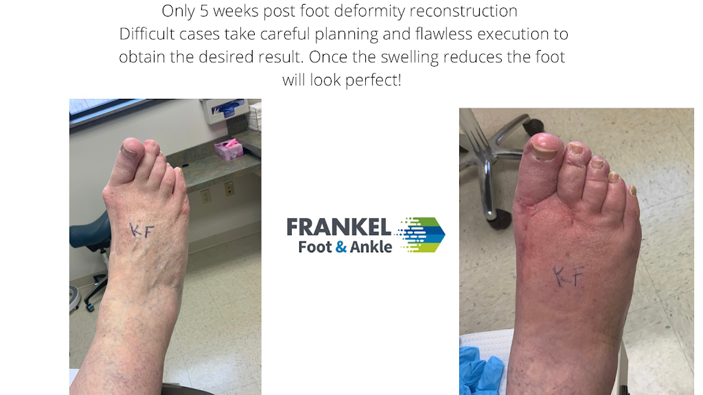 Frankel Foot & Ankle Center - Warwick Office | 2 Overlook Dr, Warwick, NY 10990, USA | Phone: (845) 343-6050