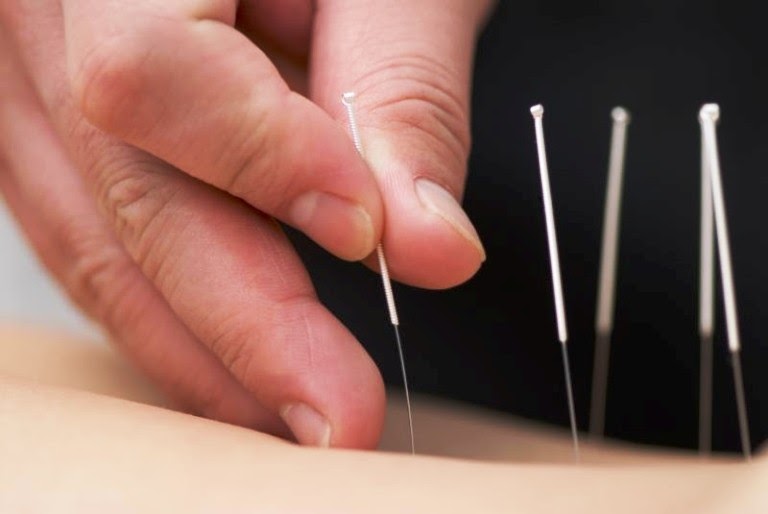 Acu-Care Acupuncture Clinic, Inc | 6633 N Mesa St, El Paso, TX 79912, USA | Phone: (915) 585-6222