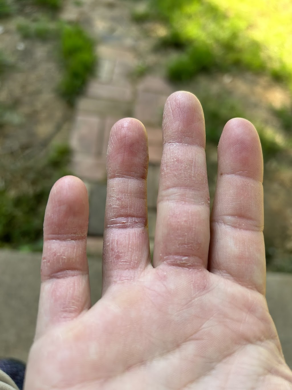 Metroplex Dermatology | 300 W Arbrook Blvd Suite D, Arlington, TX 76014, USA | Phone: (817) 704-4777