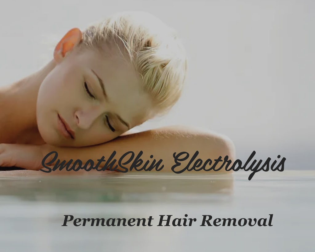Smooth Skin Electrolysis, LLC - Permanent Hair Removal by Carrie | 2025 Holding Pond Ln, Midlothian, VA 23112, USA | Phone: (804) 338-0438
