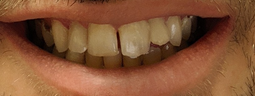 Lancaster Dental | 847 W Sand Lake Rd, Orlando, FL 32809, USA | Phone: (407) 855-6616