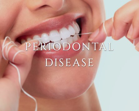 Periodontal Specialists | 2647 Superior Dr NW, Rochester, MN 55901, United States | Phone: (507) 288-1338