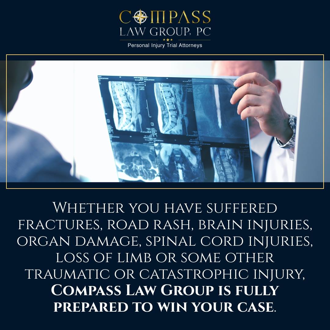 Compass Law Group LLP Injury and Accident Attorneys | 8665 Wilshire Blvd #302, Beverly Hills, CA 90211, United States | Phone: (310) 289-7126