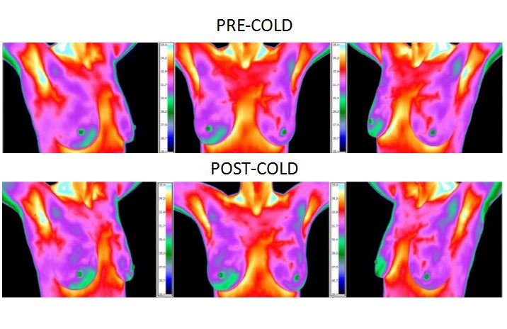THERMOGRAPHY CLINIC | 3060 Ogden Ave #200, Lisle, IL 60532, USA | Phone: (630) 778-2195