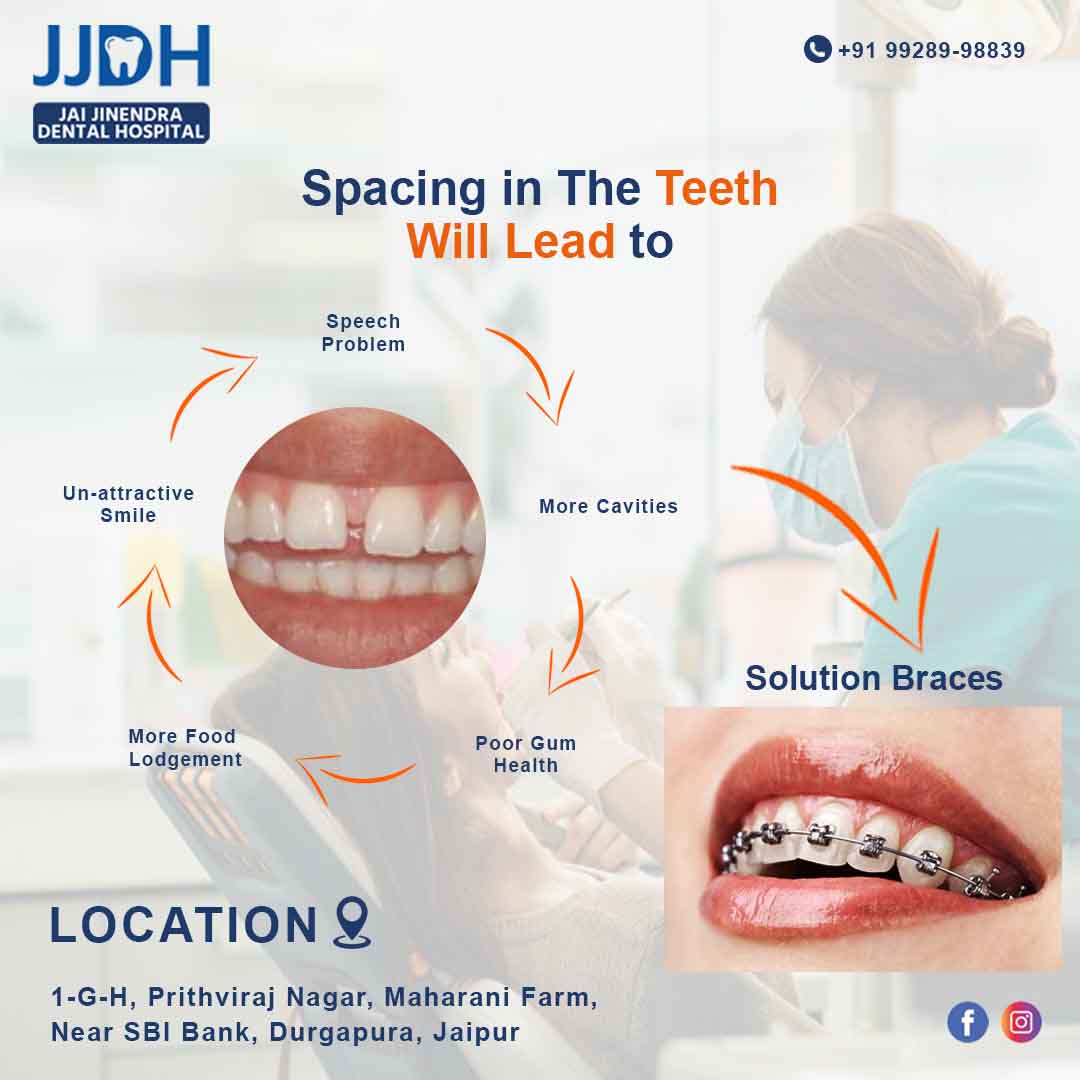 Jai Jinendra Dental Hospital | Maharani farm 1-G-H, Dalda Factory Rd, near SBI Bank, Prithviraj Nagar, Durgapura, Jaipur, Rajasthan 302018, India | Phone: (992) 899-8839