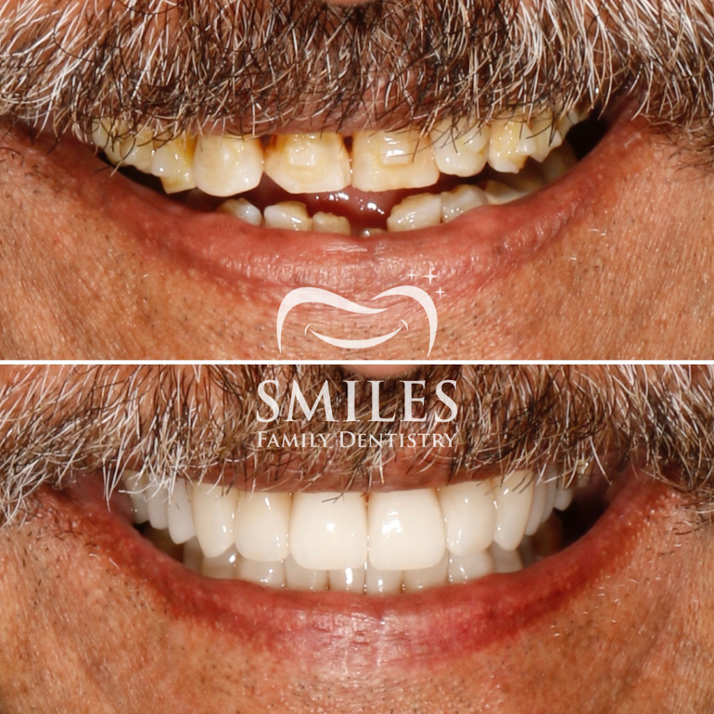 Promenade Smiles Family Dentistry | 315 US-206 Suite 903, Hillsborough Township, NJ 08844, USA | Phone: (908) 829-4668