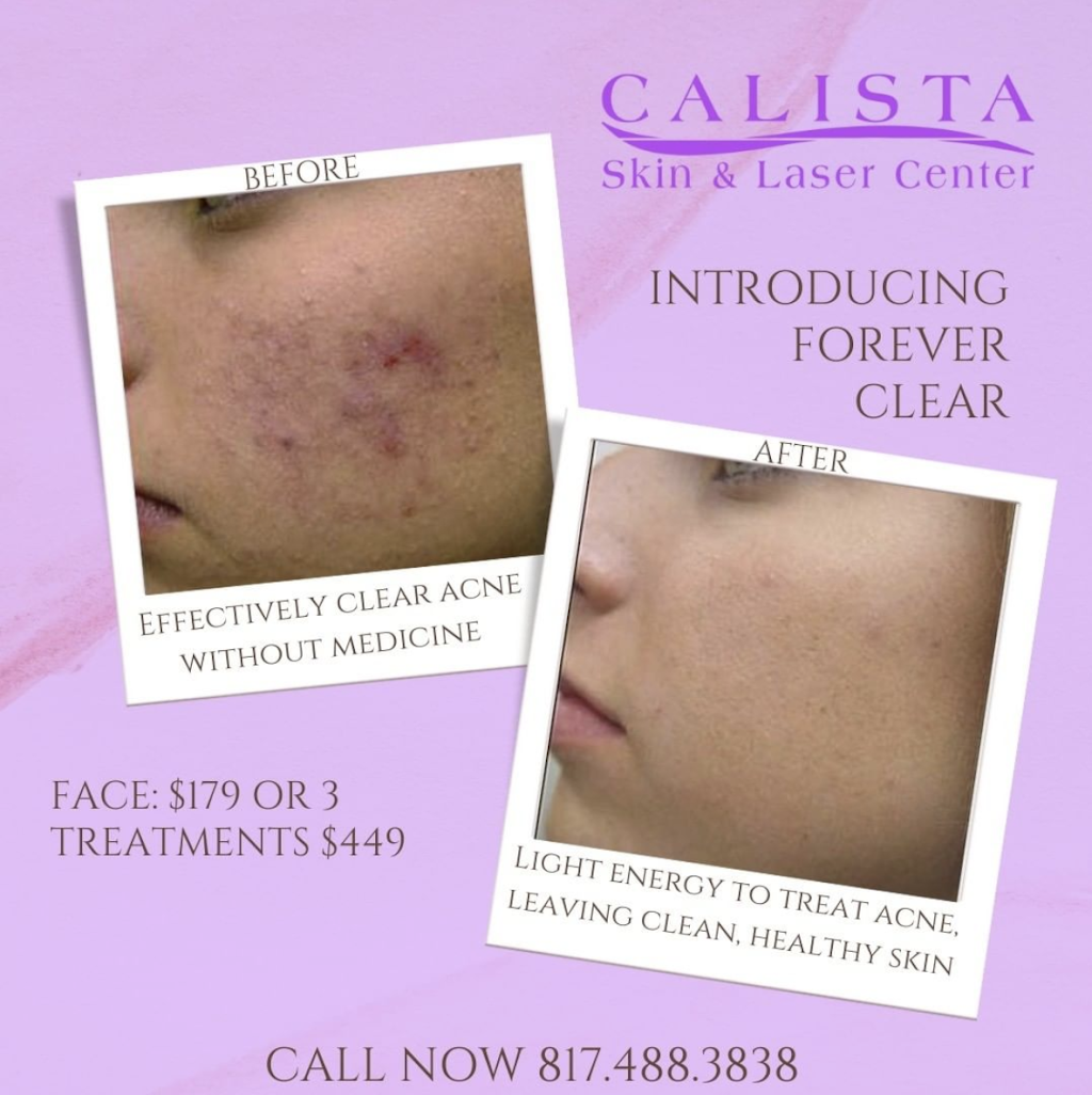 Calista Skin and Laser Center | 6100 Colleyville Blvd #165, Colleyville, TX 76034, USA | Phone: (817) 488-3838