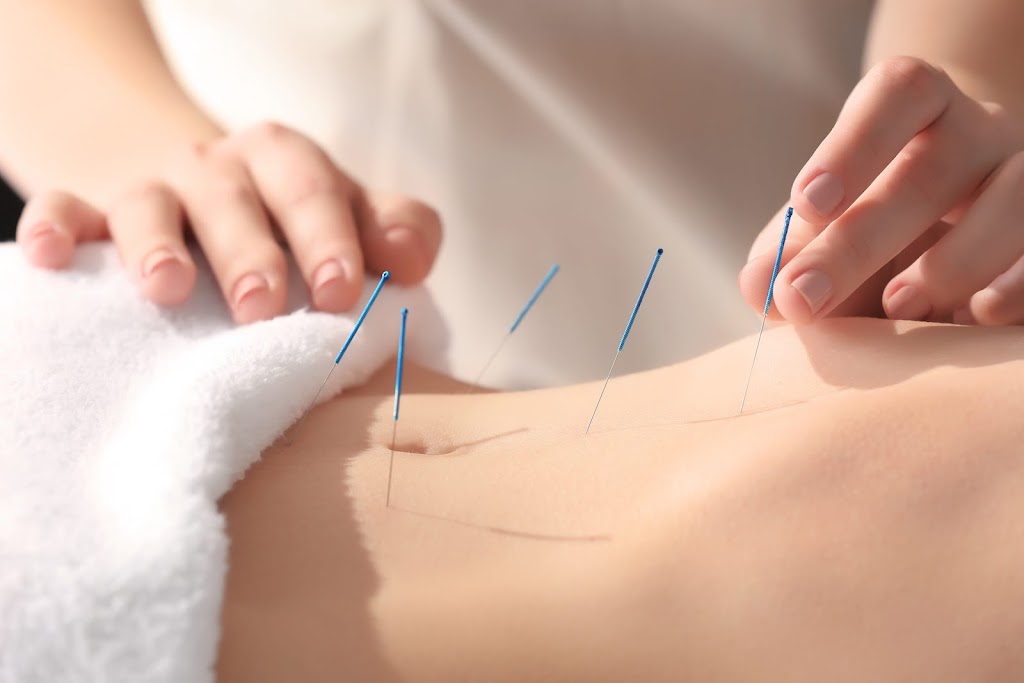 Ming Acupuncture and Wellness Apex | 2201 Candun Dr Ste 104, Apex, NC 27523 | Phone: (919) 823-1789