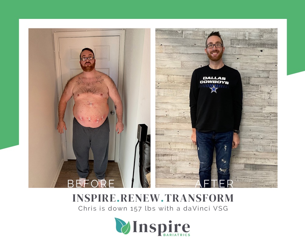 Inspire Bariatrics | 5561 Virginia Pkwy Suite 300, McKinney, TX 75071, USA | Phone: (469) 634-1004