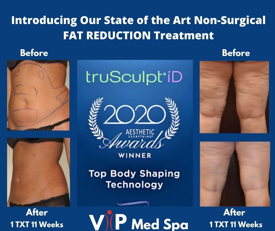 VIP Med Spa and Weight Solutions | 5899 Preston Rd Suite 1002, Frisco, TX 75034, USA | Phone: (972) 378-0066