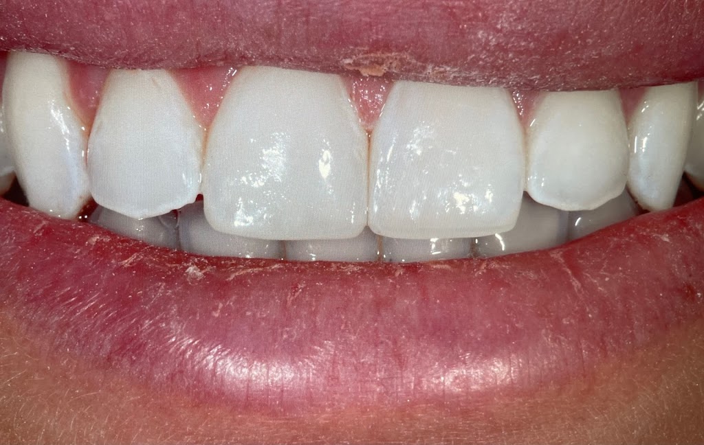 Bassett Joyce DDS | 3697, 14275 N 87th St # 215, Scottsdale, AZ 85260, USA | Phone: (480) 367-8889