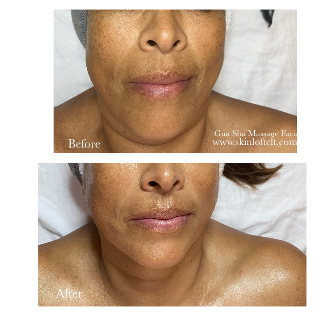 Skin Loft | 9904 Sandy Rock Pl, Charlotte, NC 28277, USA | Phone: (704) 582-2034