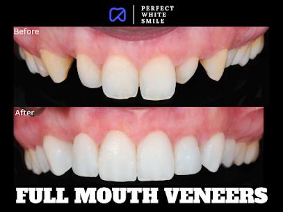 Perfect White Smile Beverly Hills | 433 N Camden Dr # 1070, Beverly Hills, CA 90210, United States | Phone: (310) 276-4537