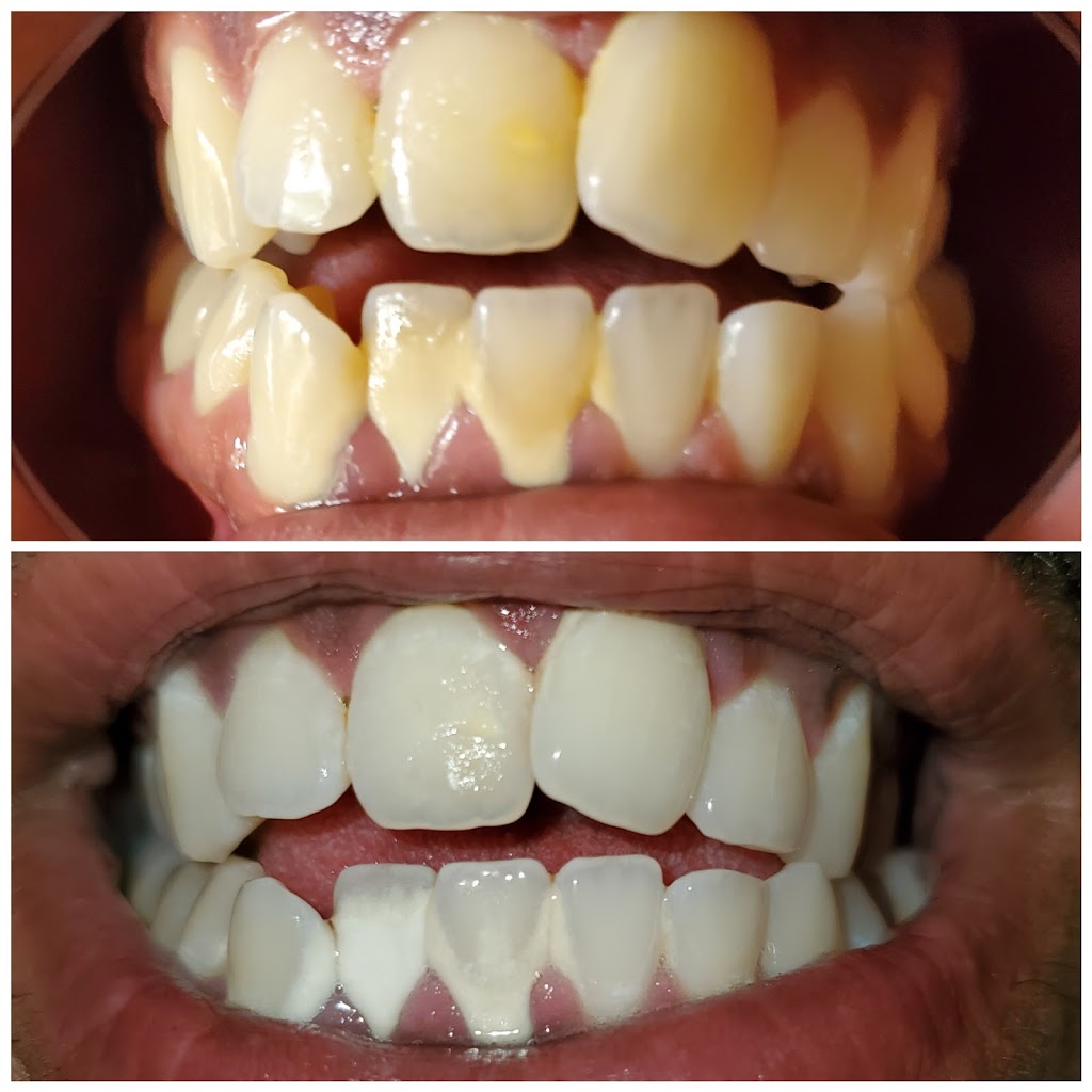 New Smiles Teeth Whitening | 222 Grifford Dr, Kissimmee, FL 34758, USA | Phone: (407) 279-0490