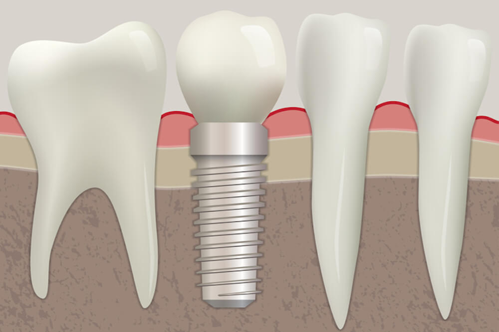 Polo Park Dental Centre | 1440 Jack Blick Ave #104, Winnipeg, MB R3G 0L4, Canada | Phone: (204) 774-2521