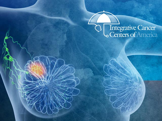 Integrative Cancer Centers of America | 4370 La Jolla Village Dr, San Diego, CA 92122, United States | Phone: (888) 526-6398